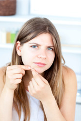 Acne affects nearly 85 percent of young adults